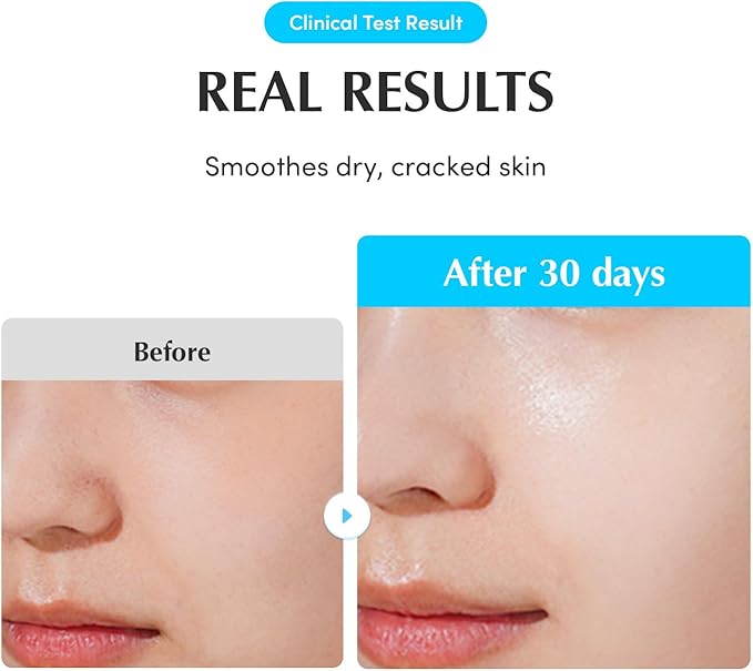 أمبولة يومية لحمام السباحة 50 مل