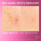 L’Oréal Paris Glycolic Bright Serum 30Ml.