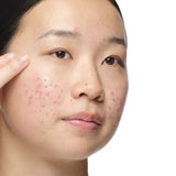 The Ordinary Aloe 2% + NAG 2% Solution.